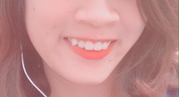 Khoe môi gợi cảm tiện thể khoe luôn ria mép, cô gái khiến cư dân mạng mắt xem ảnh tay nhặt mồm vì cười Khoe môi gợi cảm tiện thể khoe luôn ria mép, cô gái khiến cư dân mạng mắt xem ảnh tay nhặt mồm vì cười